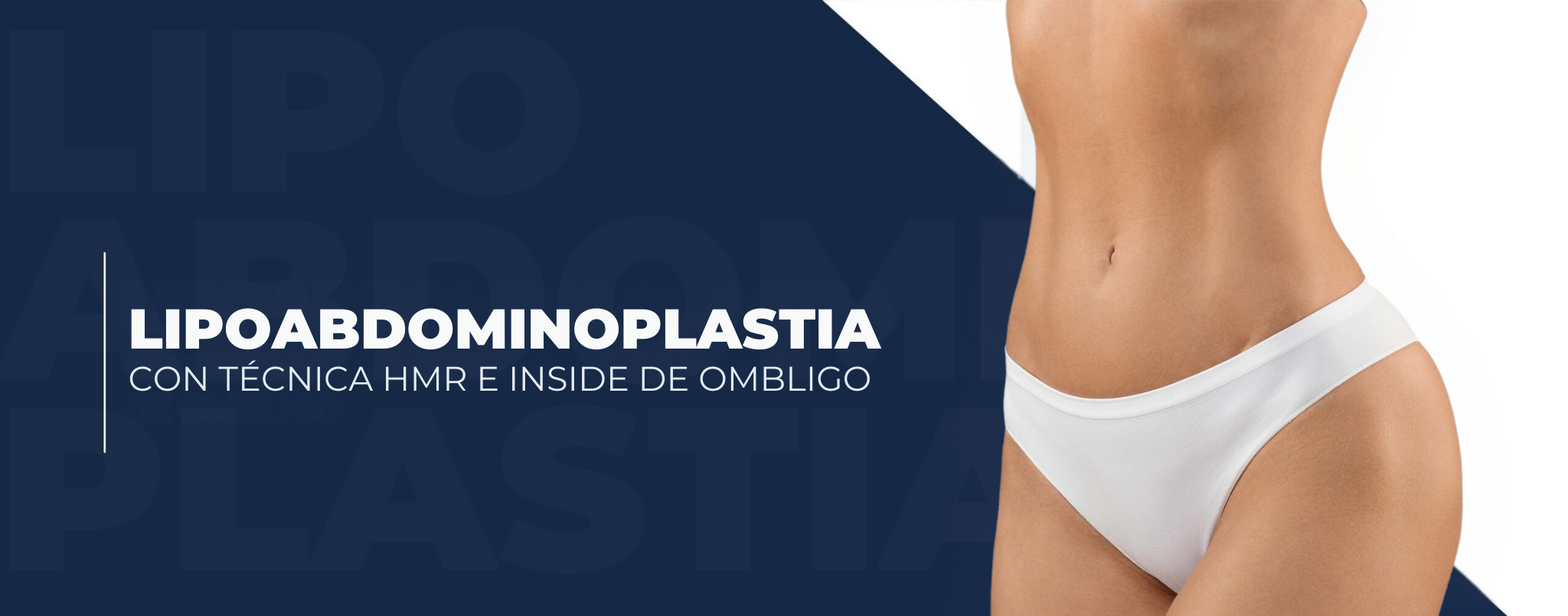 Lipoabdominoplastia