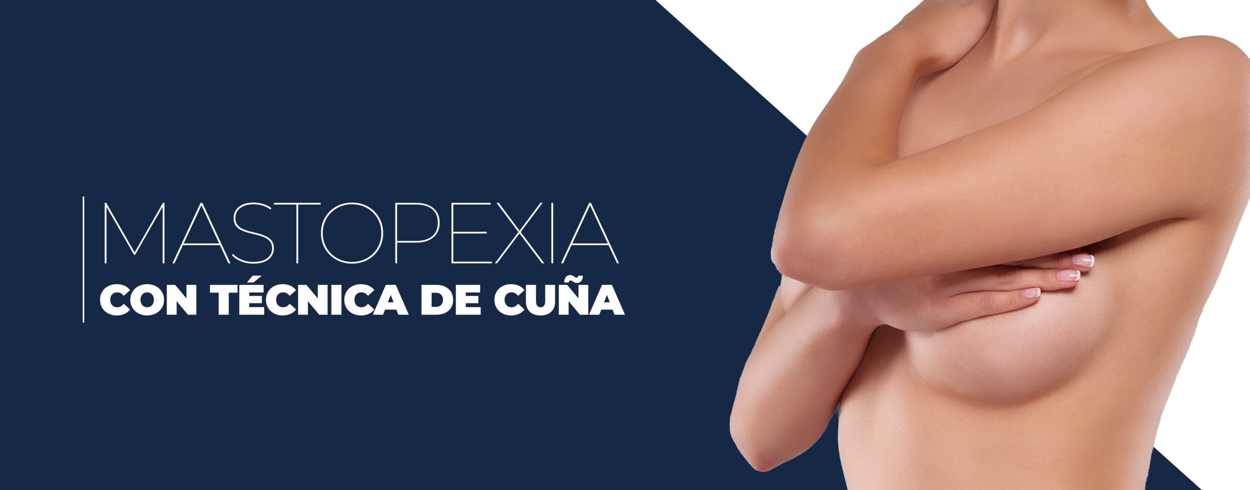 Mastopexia